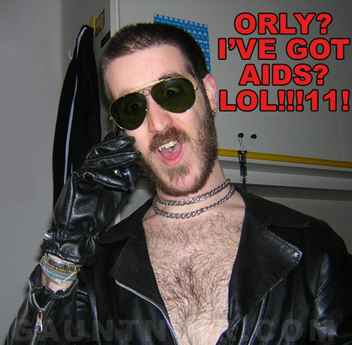 Gaunt AIDS